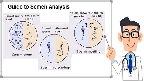 Understanding Semen Analysis .